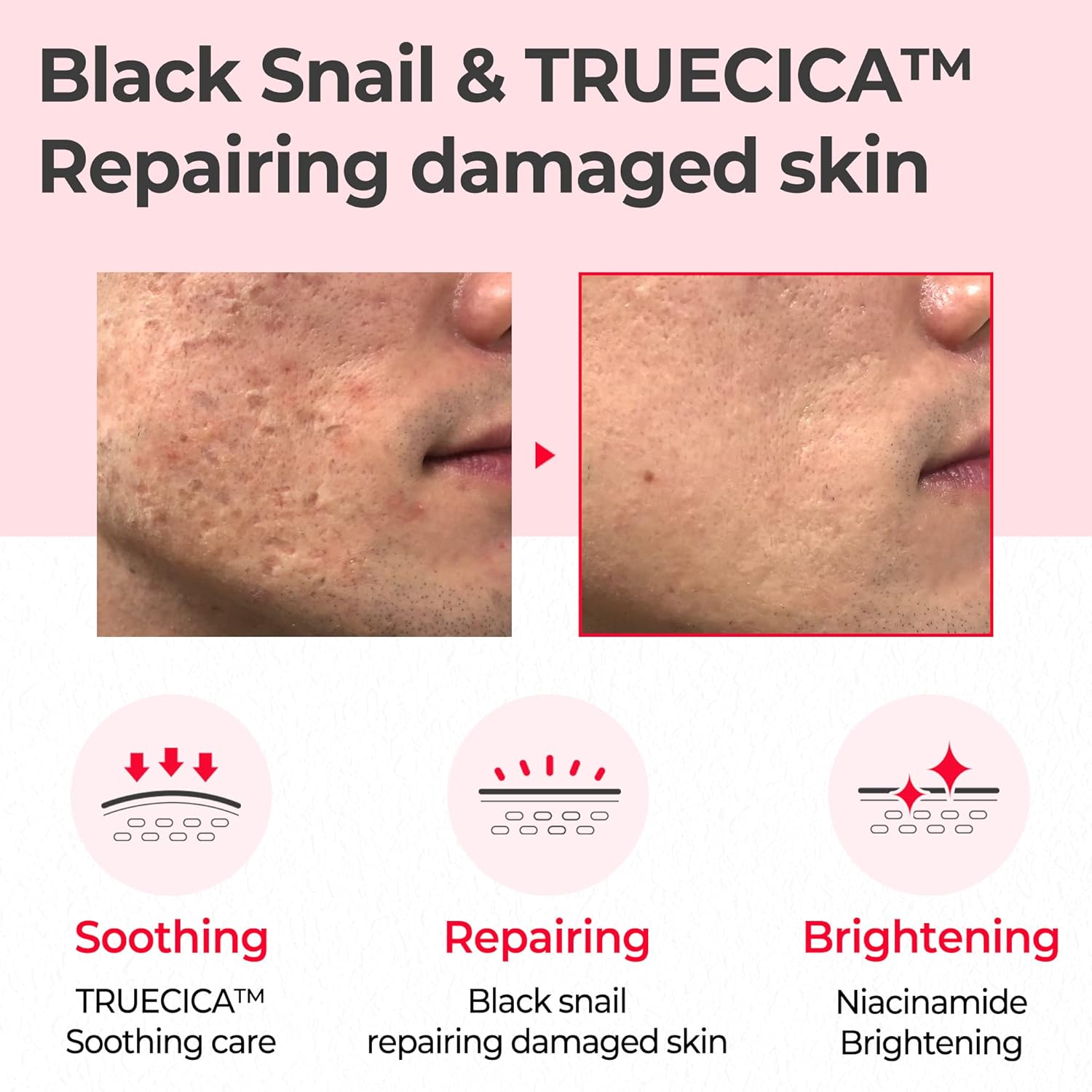 SOME BY MI - Snail Truecica Miracle Repair Toner - 135 ml